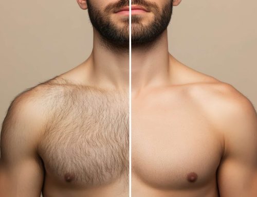 Depilación con láser sin dolor en Astillero: qué zonas del cuerpo se pueden tratar